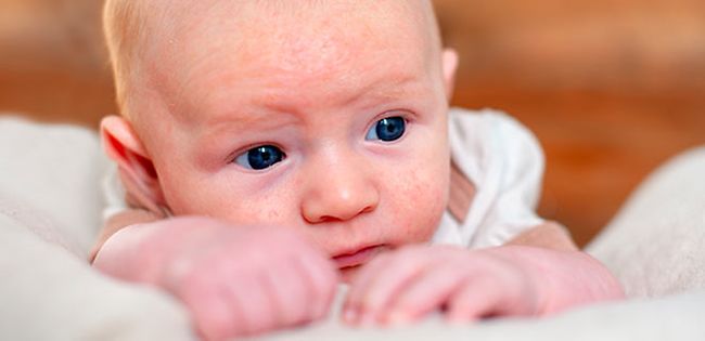 كيفية التعامل مع أكزيما الرضع